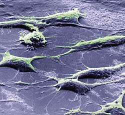 Стволовые клетки (это интересно знать)